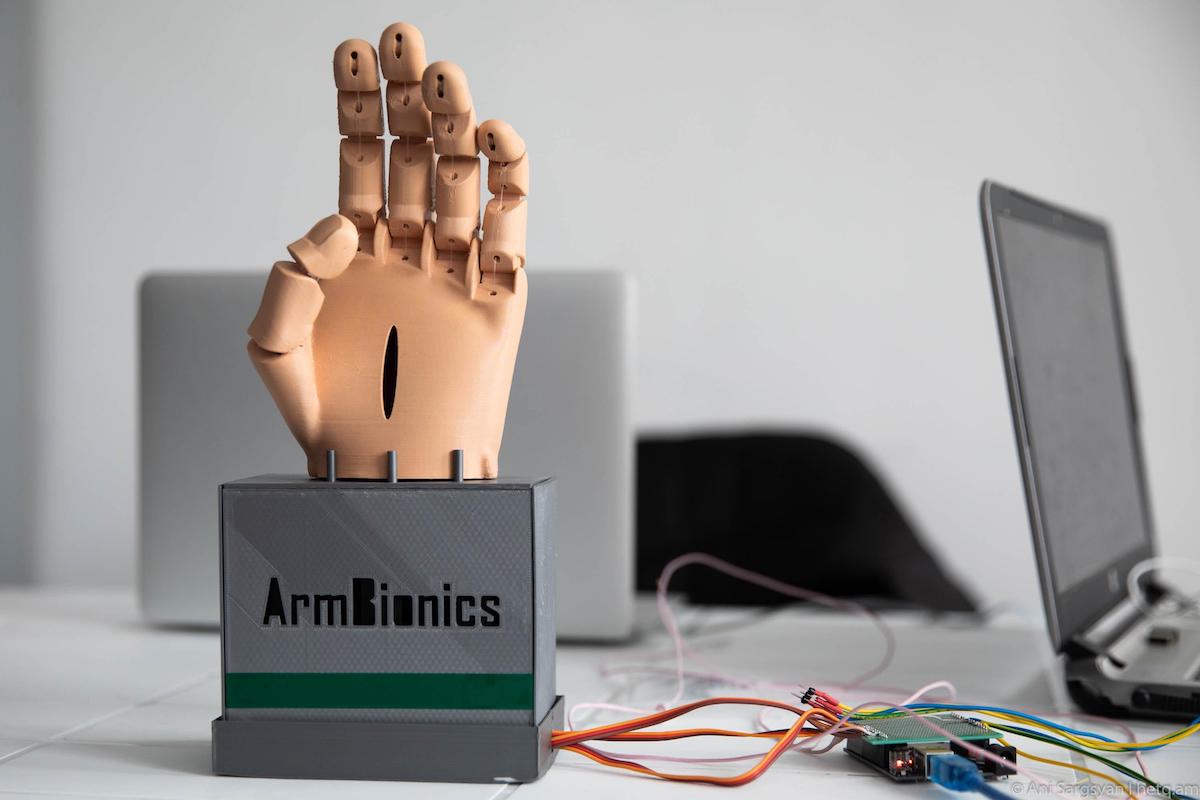 3D printing myoelectrical prosthetics